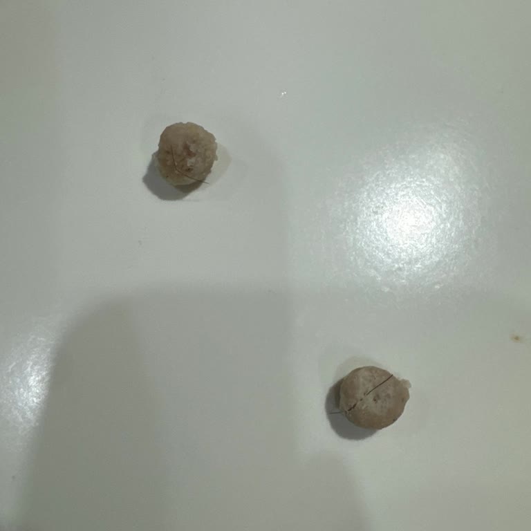 Aile Tüketiminde Ürünlerde Kıl Çıktı, Tekrarlayan Mide Bulantısı