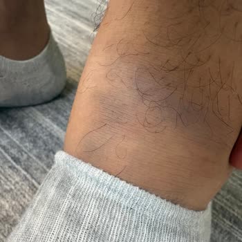 Deichmann Ayakkabısının Boya Sızıntısı Ve Bilgilendirme Eksikliği