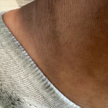 Deichmann Ayakkabısının Boya Sızıntısı Ve Bilgilendirme Eksikliği