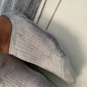 Deichmann Ayakkabısının Boya Sızıntısı Ve Bilgilendirme Eksikliği