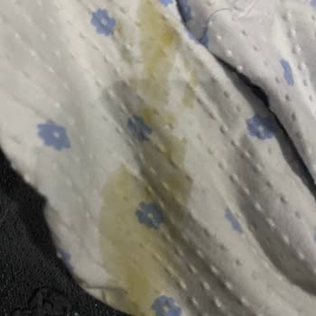 Trendyol Molfix Premium Bebek Bezi Sızdırma Ve Cilt Tahrişi Nedeniyle Şikayet