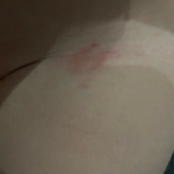 Trendyol Molfix Premium Bebek Bezi Sızdırma Ve Cilt Tahrişi Nedeniyle Şikayet