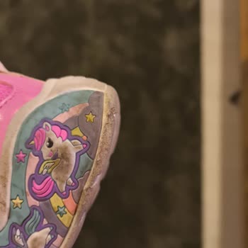 Skechers Çocuk Ayakkabısında 1 Hafta Sonra Aşırı Soyulma Ve Deformasyon