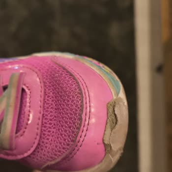 Skechers Çocuk Ayakkabısında 1 Hafta Sonra Aşırı Soyulma Ve Deformasyon