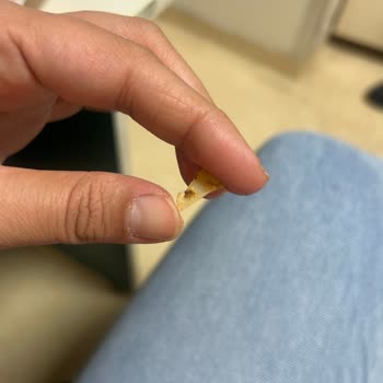 İzmir Onur Şubesinde Tavuk Dönerde Plastik Parça Ve Sağlık Riski