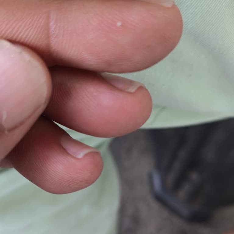 Dalin Kolay Tarama Saç Spreyi Çocukta Bit Ve Saç Derisi Tahrişi Yarattı