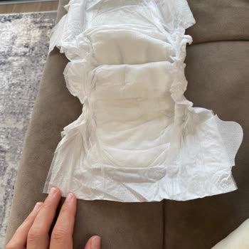 Eksik Parçalı Sleepy Bebek Bezinde Üretim Hatası Ve Telafi Talebi