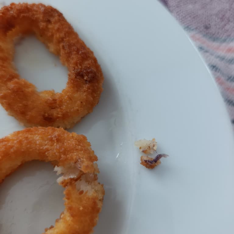 Nimet Dondurulmuş Soğan Halkasında Yabancı Madde Ve Hijyen İhlali