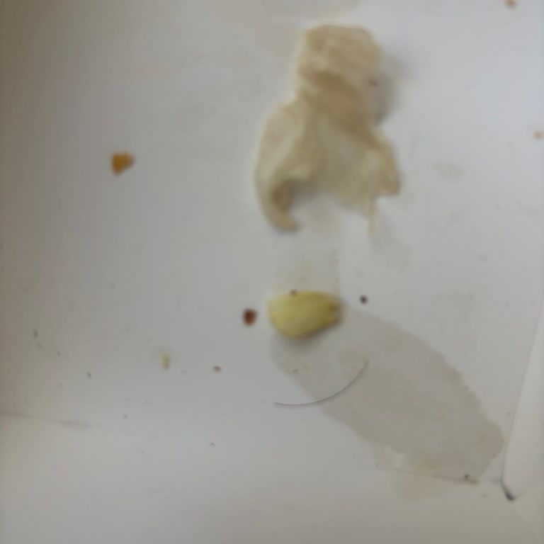 Yemeksepeti Üzerinden Sipariş Edilen Burger King Menüsünde Kıl Ve Buz Gibi Patates Hijyen Sorunu