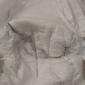 Molfix Bebek Bezinde Yağ Benzeri Yabancı Madde Ve Sağlık Riski