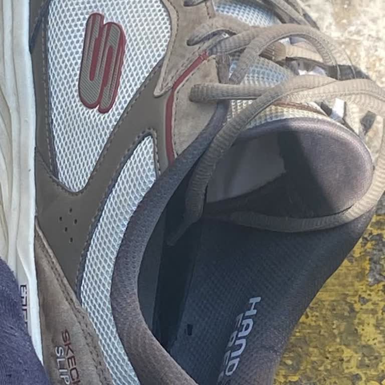 Skechers Ayakkabımda Kısa Sürede Delik Ve Trendyol’da Yetersiz Destek