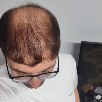 Denizli Suit Beauty Güzellik Merkezi Hem Maddi Hem de Manevi Olarak Mağdur Durumdayım