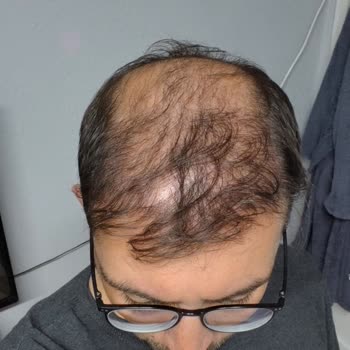 Denizli Suit Beauty Güzellik Merkezi Hem Maddi Hem de Manevi Olarak Mağdur Durumdayım