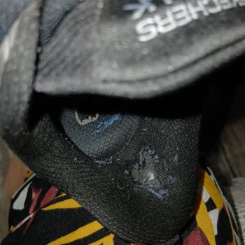 Skechers Ayakkabısındaki İç Taban Ve Astar Yırtılması Nedeniyle Reddedilen İade Ve Değişim Talebi
