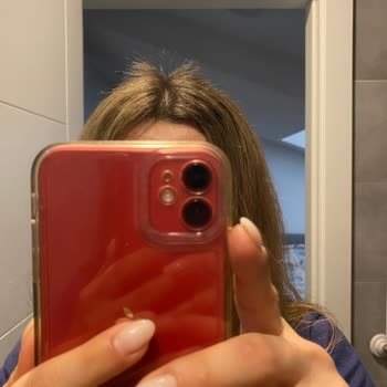 Açıcı Fazla Kaldığı İçin Saçım Koptu, Salon Sorumluluk Almıyor Ve İade İstiyorum
