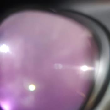 Lens Sorunu Reddedildi, Garanti Kapsamında Ürün Değişimi Talebi