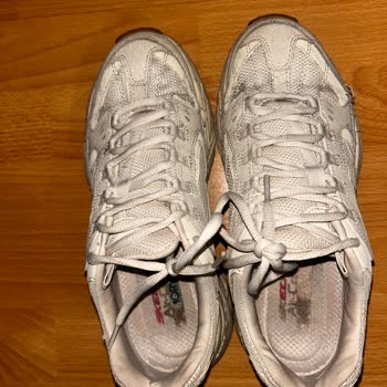 Skechers Ayakkabısında Kısa Sürede Deformasyon Ve Personelin Kaba Tutumu