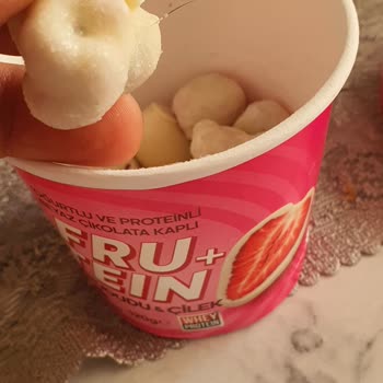 Meyve Topunda Kıl Bulundu: Hijyen Ve Sağlık Endişesi