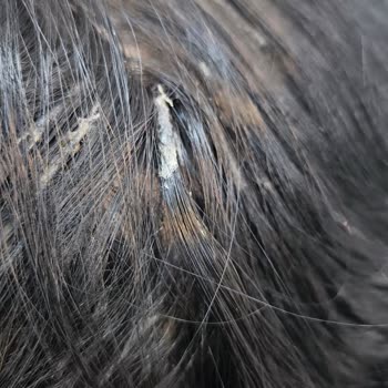 Mert Yıldırım Türk Hair House Yapılan İşlemden Kesinlikle Memnun Kalmadım