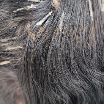 Mert Yıldırım Türk Hair House Yapılan İşlemden Kesinlikle Memnun Kalmadım