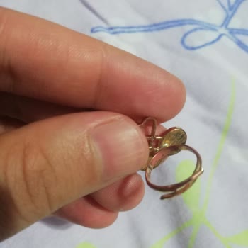 Çocuk Yüzüğünün Hızlı Paslanması Ve Cilt Tahrişi