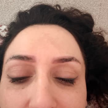 Yanıltıcı Reklam Ve Gerçekleşmeyen Kaş Silme Vaadi Nedeniyle Ücret İadesi Talebi