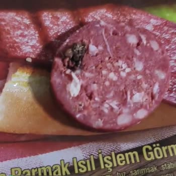 Namet Dana Sucuktan Çıkan Kıl Ve Deri Parçası