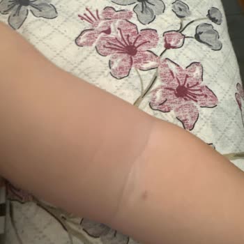 Hemşirenin Saygısız Tavrı Ve Çocuğumun Kan Alma Sırasında Yaşadığı Acı