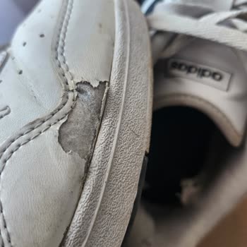 Adidas’a 5 Aylık Ayakkabının Yıpranması Ve Değişim Reddi Hakkında Şikayet