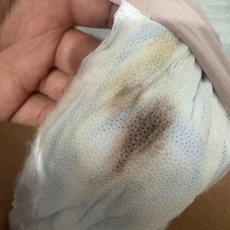 Etlik Şehir Hastanesi HSG İşleminde Kaba Ve Duyarsız Davranış Kanama Ve Şiddetli Ağrıya Yol Açtı