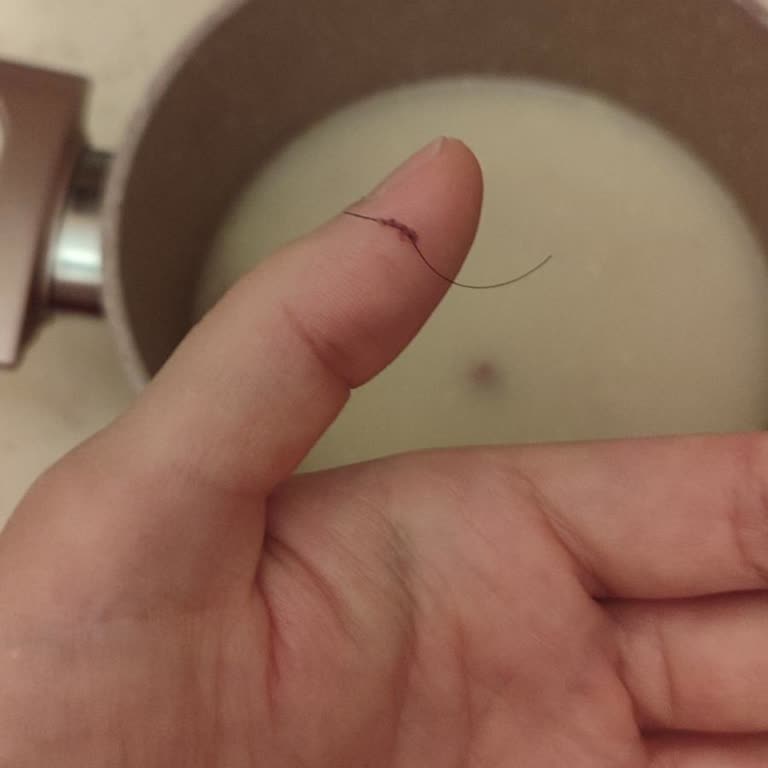 Kelle Paça Çorbasında Kıl Bulunması Hijyen İhlali Ve İade Talebi