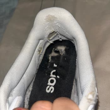 FLO'dan Alınan Adidas Ayakkabının İç Kısmı 6 Ayda Tüylendi Ve Yırtıldı, Kullanıcı Hatası Söylendi
