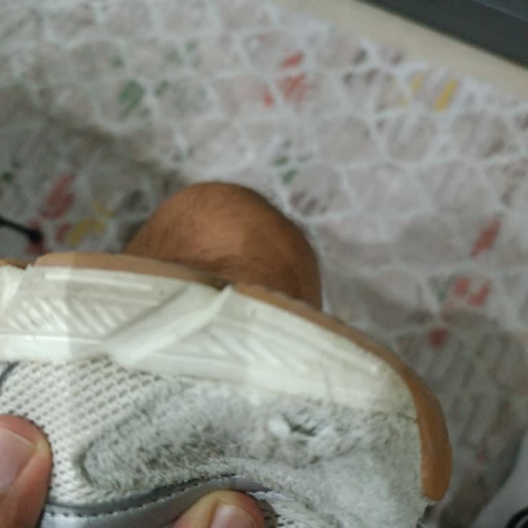 Sol Ayakkabıda Üretim Hatası Ve Garanti Reddi