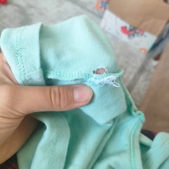 Bebek Kıyafetlerinde Uzun Etiketler Cilt Tahrişi Ve Kumaş Yırtılmasına Neden Oluyor