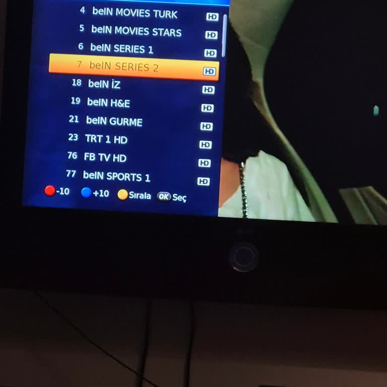 Kanal Atlama Sorunu İçin 700 TL Servis Ücretine Karşı Çıkıyorum