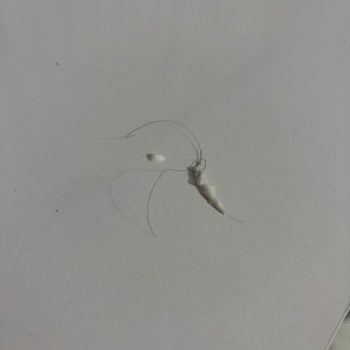 BİM Dost Yoğurtta Saç Çıktı, Hijyen İhlali Ve Çocuk Sağlığı Tehlikede