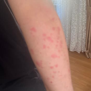 Tree Home Sapanca’da Tahtakurusu Ve Hijyen Sorunları Nedeniyle Tam Ücret İadesi Talebi