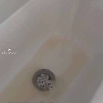 Etlik Şehir Hastane Çocuk Bölümü Sıkıntılı!