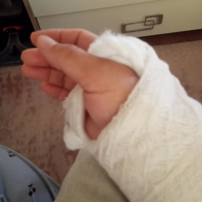 Hop Uygulamasında Kasksız Ve Kolluksuz Hizmet Nedeniyle Kaza