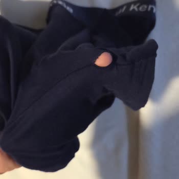 Defolu Boxer İçin Değişim Talebi Ve Soğuk Müşteri Temsilcisi