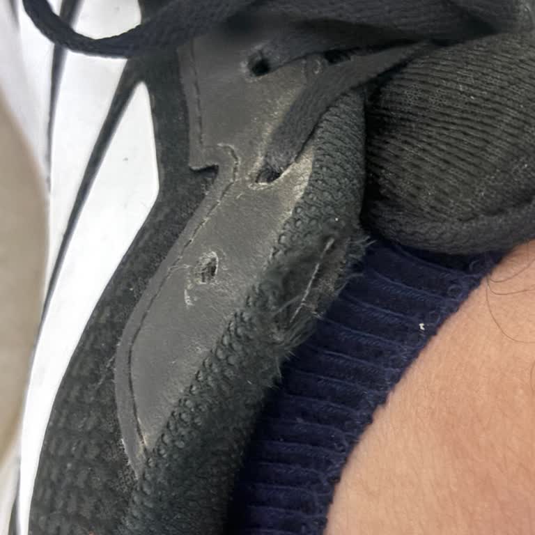 Yeni Adidas Ayakkabısının 16 Gün İçinde Yırtılması Ve Dayanıklılık Sorunu