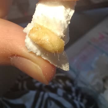 Anpa Gross Beze Tatlısında Karides Benzeri Yabancı Madde Ve Sağlık Riski