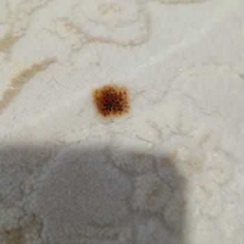 Aytemiz Halı’da Temizlenmemiş Ve Yanık İzli Halı, Hakaretli Mesajlar Ve Engelleme