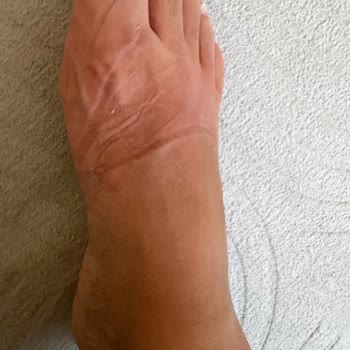 Kusurlu Loafer'da Dar Kalıp Ve Renk Akması İade Reddi