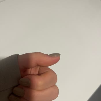 Kalın Ve Hatalı Protez Tırnak Uygulaması Ve Yetersiz İade