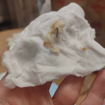 Burger King Siparişinde Beyaz Yabancı Madde Ve Sağlık Riski