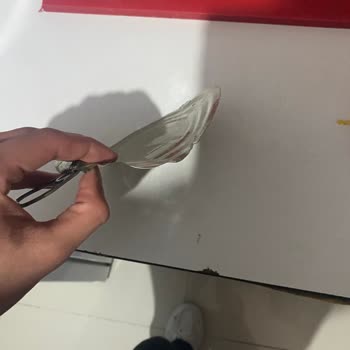 Keskin Kenarlı Konserve Açarken Elime Dikiş Atıldı