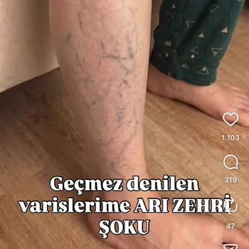 Avukatannennblogu Arı Zehri Adıyla Satılan Ürün