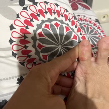 Greyder Kadın Spor Ayakkabısının Sert Yapısı Ayak Yaralarına Neden Oldu