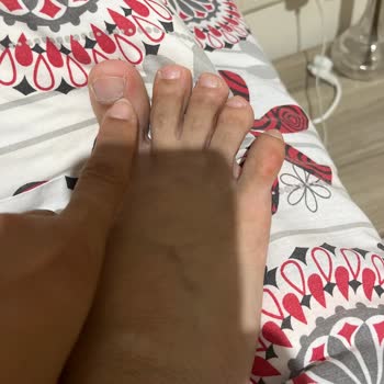 Greyder Kadın Spor Ayakkabısının Sert Yapısı Ayak Yaralarına Neden Oldu